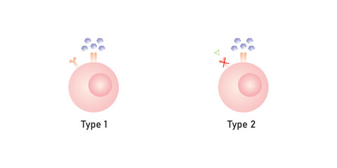 Diabetes Mellitus (Type 1 and Type 2 Diabetes) Scientific Design. Vector Illustration.