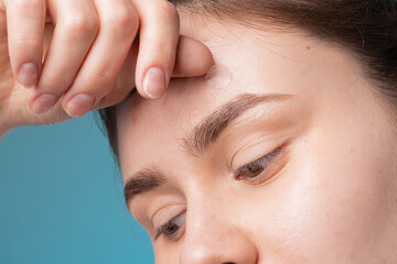 girl with acne stick round acne patch on her cheek. using acne patches for treatment of pimple and r