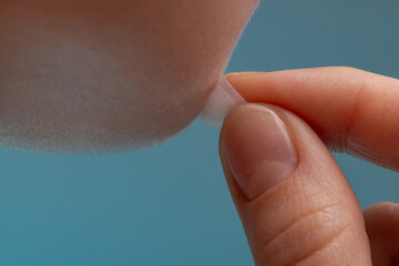 girl with acne stick round acne patch on her cheek. using acne patches for treatment of pimple and r