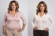 Middle aged overweight woman before and after slimming. Weight loss as a result of diet, liposuction, healthy lifestyle. 