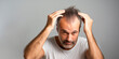middle-aged man with a thoughtful expression and examining his hair as he examines his receding hairline﻿ - concept of concern for balding