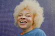 © Anna Neubauer - Closeup portrait of young woman with albinism in front of blue wall smiling into camera