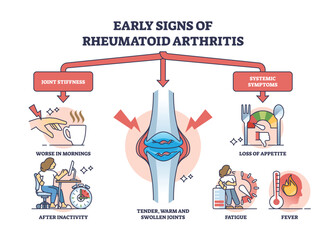 Poster - Early signs of rheumatoid arthritis disease and joint pain outline diagram. Labeled educational stiffness and systemic symptom explanation vector illustration. Cartilage tender, warm and swollen.