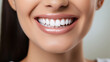 © hakule - Smiling woman with white teeth, close-up of teeth on face
