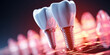 A close-up of a modern tooth implant in a patient's mouth, showcasing the seamless blend of dental innovation and natural appearance