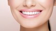 © masyastadnikova - Beautiful woman's smile with healthy white, straight teeth close-up on light background with space for text