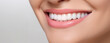 © masyastadnikova - Banner of Beautiful woman's smile with healthy white, straight teeth close-up on one tone background with space for text