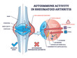 Autoimmune activity in rheumatoid arthritis skeletal disease outline diagram. Labeled educational scheme with body immune system attack to tissues with cells vector illustration. Bone inflammation.