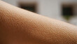 Goosebumps when listening to music or out of fear.
