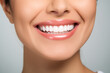 © Olivia - Banner perfect white teeth. Female smile, dental care and stomatology, dentistry. Advertising of a dental clinic