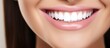 Choice of tooth tone at dental clinic for caucasian woman's perfect smile. Modern dentistry with whitening, implants, and veneers.
