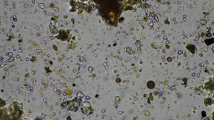 Sticker - Microorganisms and biology in Compost and soil sample under the microscope in australia in a lab
