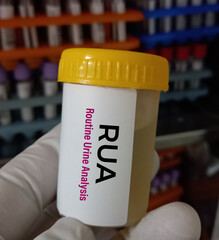 Sticker - Urine sample for RUA (Routine Urine Analysis) test. Urine RE test. urinalysis.