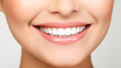© BlazingDesigns - Charming female smile with dazzling white teeth, showing excellent dental health and hygiene isolated on white background. Ideal for dental banner.
