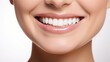 © Tirawat - A close-up photo of the lower part of a female face. Beautiful, cute smile with immaculate, perfect teeth. Chin, nose, and mouth visible.