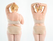 © staras - Woman's fat body before and after weight loss, plastic surgery and liposuction concept on light gray background