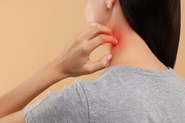 Wall Mural - Suffering from allergy. Young woman scratching her neck on beige background, back view