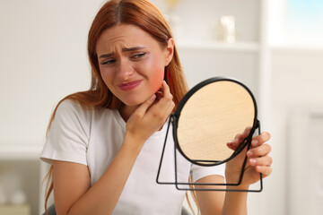 Canvas Print - Suffering from allergy. Young woman looking in mirror and scratching her neck at home