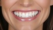 © Suleyman - Restore your smile with dental ceramic veneers to reveal immaculate, young teeth. Take close-up pictures of your top front teeth to document the significant transformation.