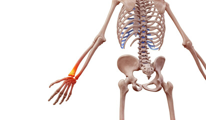 3D medical illustration of a human skeleton with wrist pain injury