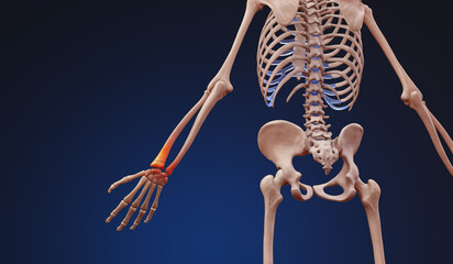 Wall Mural - 3D medical illustration of a human skeleton with wrist pain injury