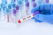 © syhin_stas - Doctor holding a test blood sample tube with STI (sexually transmitted infection) test on the background of medical test tubes with analyzes
