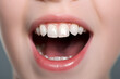 Close-up macro baby teeth. Loss of milk teeth in a child. Isolated. Open mouth scream. Visit to the dentist. toothless kid