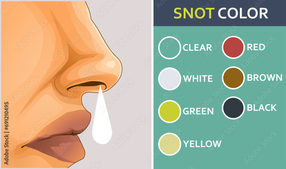 vector-de-stock-human-nose-in-profile-nasal-discharge-color-of-nasal