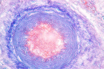 Poster - Anatomy and Histological Rea Bone marrow Human, Hyaline cartilage human and Tendon human under the microscope for education.