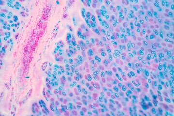 Poster - Anatomy and Histological Rea Bone marrow Human, Hyaline cartilage human and Tendon human under the microscope for education.