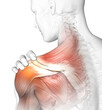 Painful shoulder joints. Frozen shoulder, Impingement. 3D illustration
