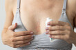 Woman in a bra for breastfeeding has allergy on her chest, holding cream for healing. Healing ointment. Closeup.
