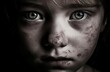 Domestic violence portrait. Physical abused child victim with injured face. Generate ai