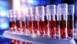 Medical test tubes. Tubes with blood in lab. Lab assistant, a medical scientist, a chemistry researcher a glass tube through the blood sample, does a chemical experiment and examines patient's