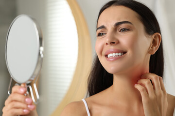 Poster - Suffering from allergy. Young woman looking in mirror and scratching her neck indoors