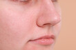 © New Africa - Closeup view of woman with blackheads on her nose against beige background