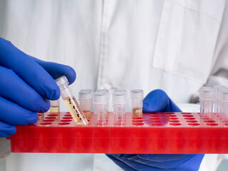 Sticker - Cryogenic test tube with liquid bacteria inside, test tubes with bacteria in a red stand, scientist takes out one test tub