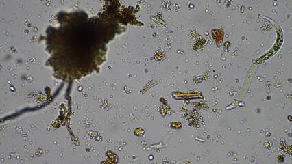 Wall Mural - Soil under the microscopy, looking at sand, silt and clay and soil biology, amoebae, fungi, fungal, microbes and nematodes in a cattle farm in australia. 
