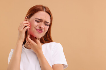 Wall Mural - Suffering from allergy. Young woman scratching her face on beige background, space for text