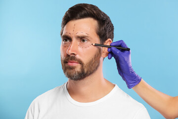 Poster - Doctor drawing marks on man's face for cosmetic surgery operation against light blue background