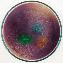 Sticker - colonies of bacteria and other microorganisms in a Petri dish on the surface of the nutrient medium