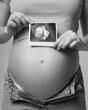Black and white photo of Pregnant female is holding sonogram baby embryo image over a pregnant belly.