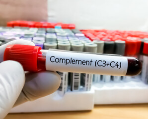 Canvas Print - Blood sample for complement (C3+C4) test