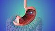 Upper gastrointestinal endoscopy medical animation