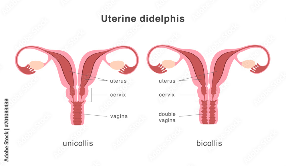 Didelphis Human Uterus Structure Of Unicollis And Bicollis Types didelphis-human-uterus-structure-of-unicollis-and-bicollis-types