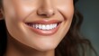 © tynza - Closeup of smile with perfrect white healthy teeth