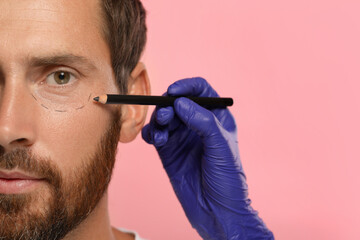 Poster - Doctor with pencil preparing patient for cosmetic surgery operation on pink background, closeup. Space for text