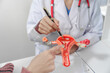© NanSan - female doctor reassuring patient with comforting hand gesture, with model of the female reproductive system on table, possibly discussing menstruation, cervical cancer, infertility, or sterilization.