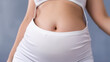 © alexkich - fat woman, fat belly, chubby, obese woman hand holding excessive belly fat with measure tape, woman diet lifestyle concept