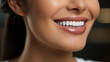© alexkich - Beautiful female smile after teeth whitening procedure. Dental care. Dentistry concept.